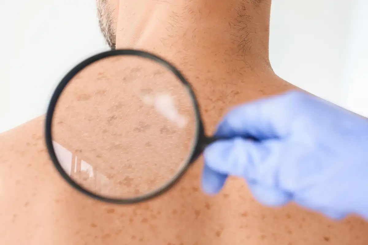 Dermatologo a Cosenza: guida pratica alla visita con il Dr. Massimo Cuconato