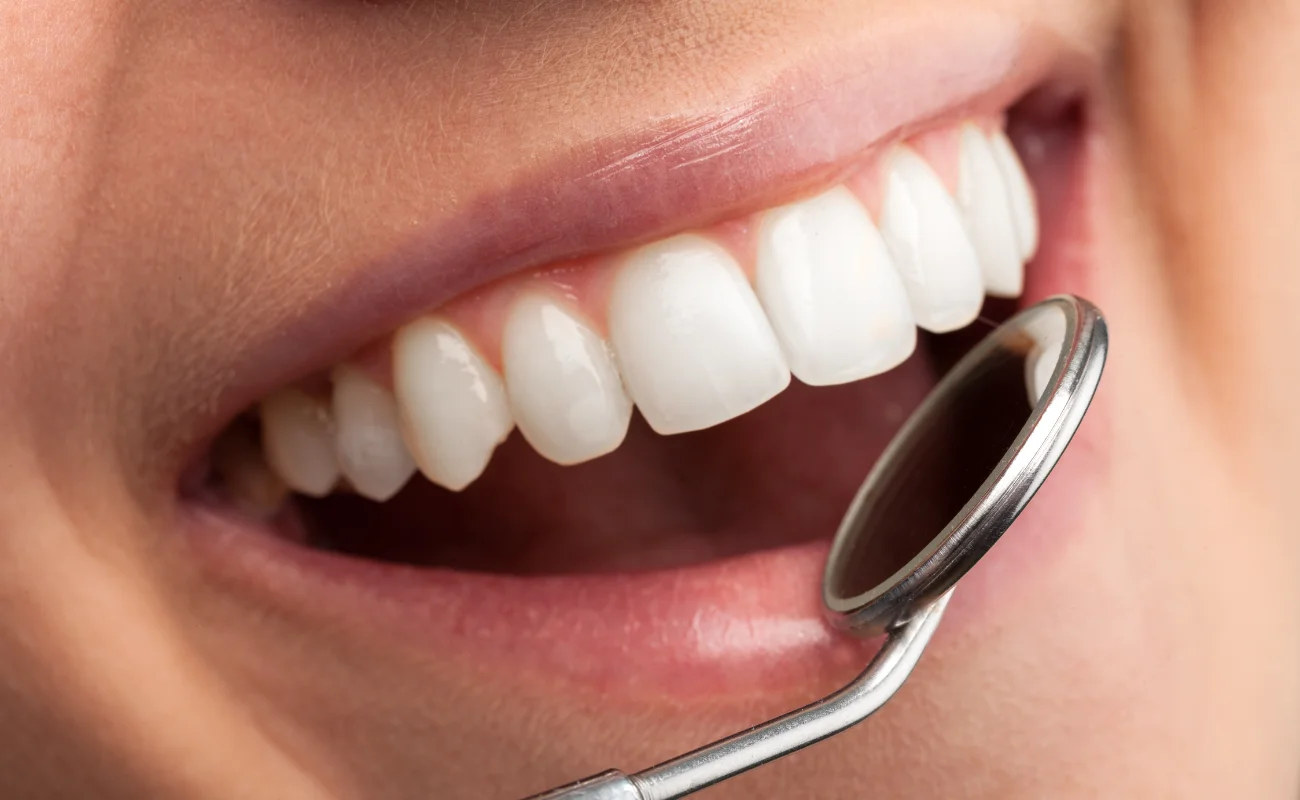 Dentista per impianti dentali a Firenze: come scegliere lo studio giusto e prepararsi all’intervento