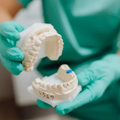 Pianificazione digitale e chirurgia dentale guidata ad Arezzo: workflow, dati e collaborazione con Officine Dentali Srl