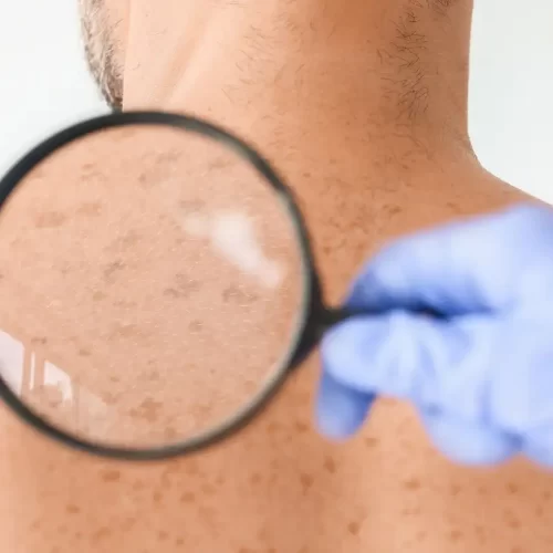Dermatologo a Cosenza: guida pratica alla visita con il Dr. Massimo Cuconato