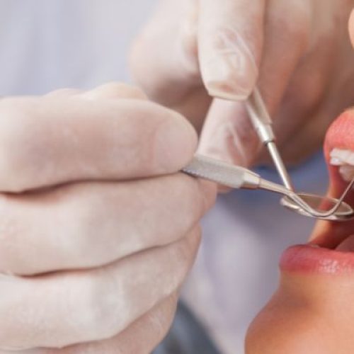 Dentista a Marsala: come scegliere il professionista giusto per la tua salute orale