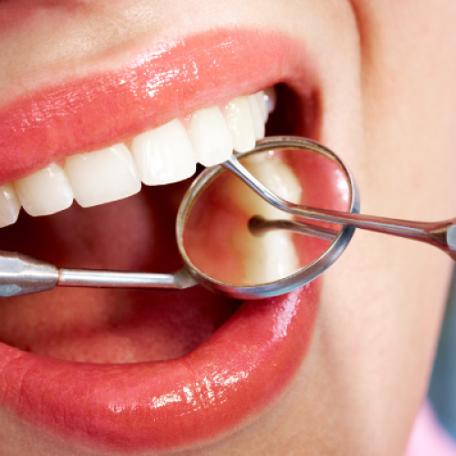 Come prendersi cura del sorriso: l’importanza dell’igiene dentale nella zona Roma Trieste Salario