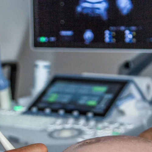 Trattamento della menopausa a Potenza: guida pratica per scegliere il percorso giusto