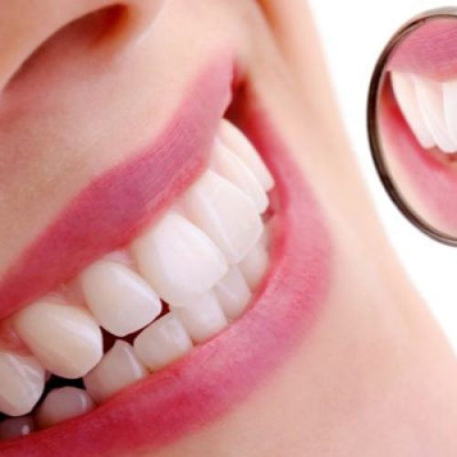 Estetica dentale a Ladispoli: il sorriso che hai sempre desiderato